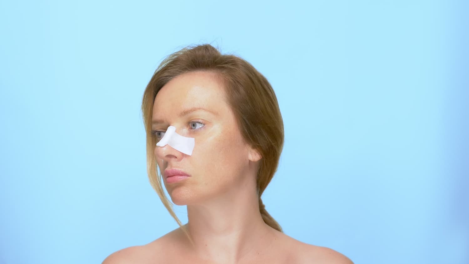 opération rhinoplastie